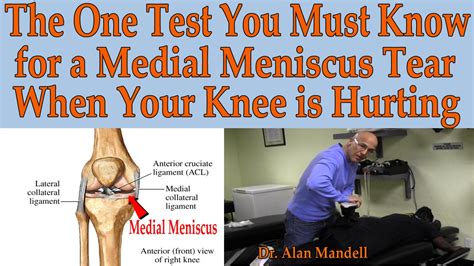 bob and brad meniscus tear test|knee meniscus tear surgery.